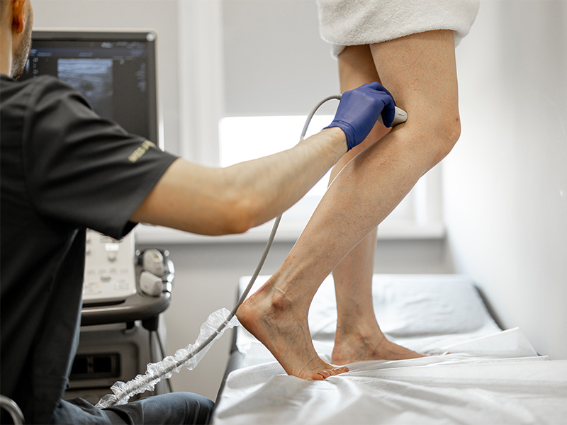 Ärztin untersucht mit einem Ultraschallgerät die Beinvenen einer Patientin zur medizinischen Abklärung von Venenveränderungen.
